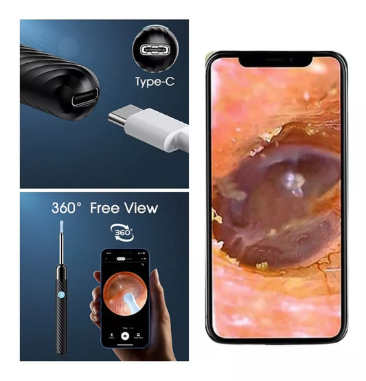 Cámara Limpieza Oído Elimina Cerumen Led HD - Metacompras