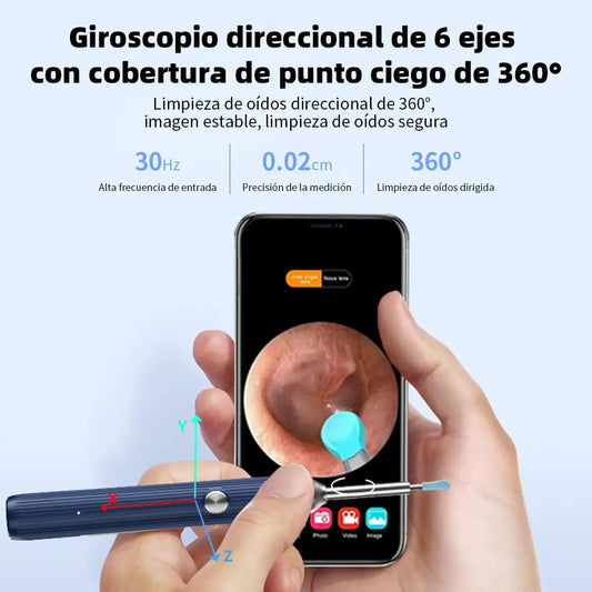 Limpiador de OΓdos Inteligente con CΓ‘mara y Carga InalΓ‘mbrica