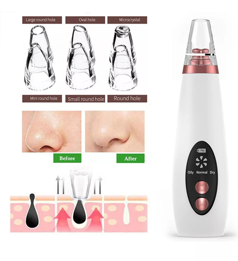 Limpiador de poros facial - Metacompras