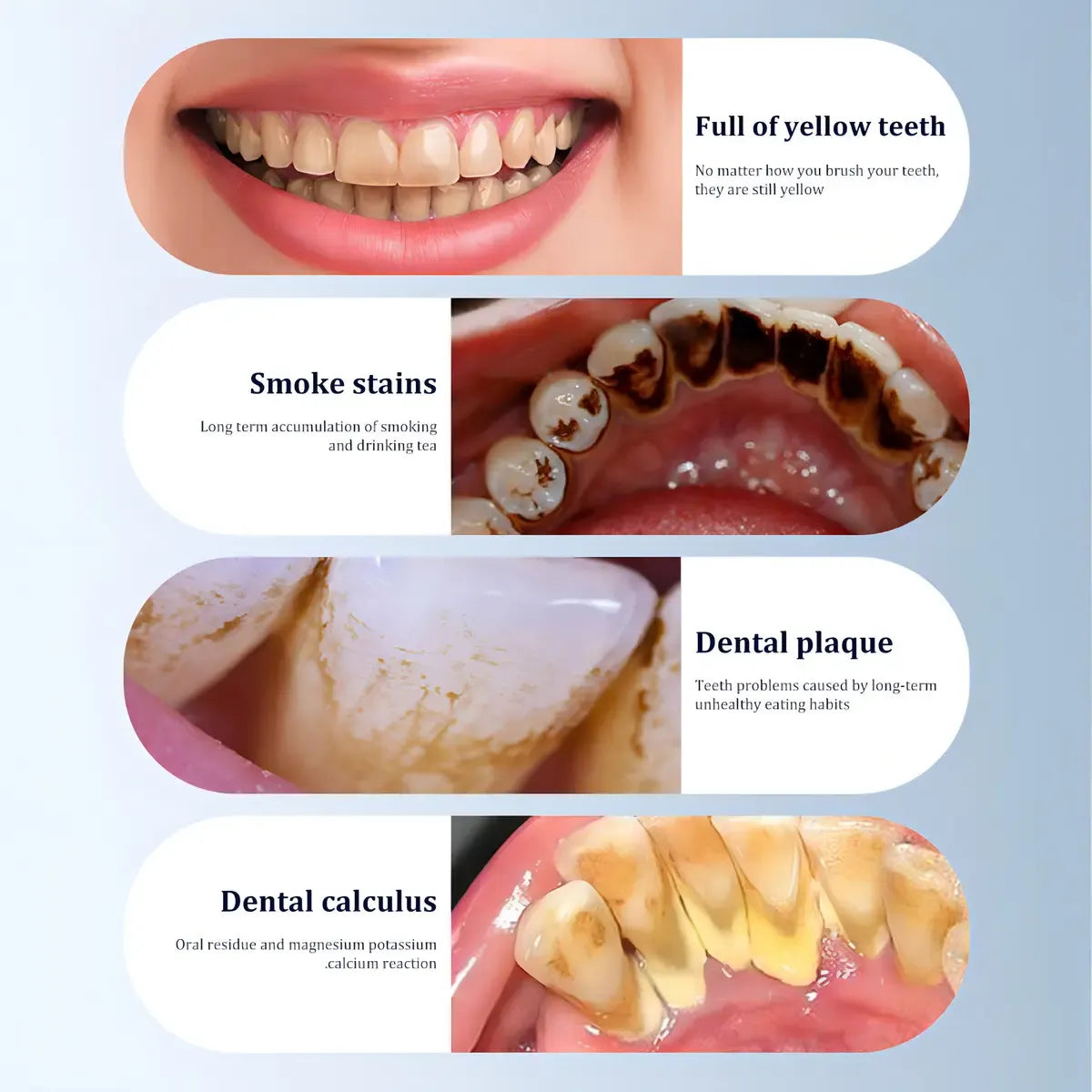 Kit Eléctrico de Limpieza Dental 3 en 1 para Eliminar Sarro y Manchas