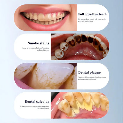 Kit Eléctrico de Limpieza Dental 3 en 1 para Eliminar Sarro y Manchas