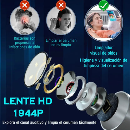 Limpiador de Oídos Inteligente con Cámara HD y Luz LED para Seguridad