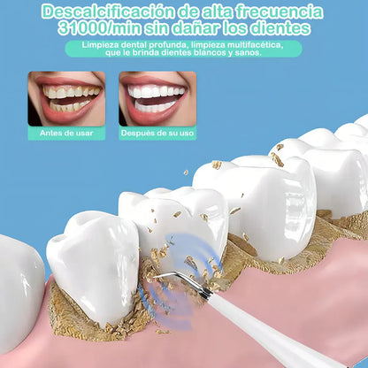 Kit Eléctrico de Limpieza Dental 3 en 1 para Eliminar Sarro y Manchas