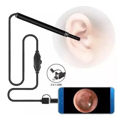 Cámara Endoscopio Del Oídos, Otoscopio Con 6 Led - Metacompras