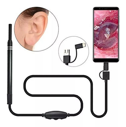 Cámara Endoscopio Del Oídos, Otoscopio Con 6 Led - Metacompras